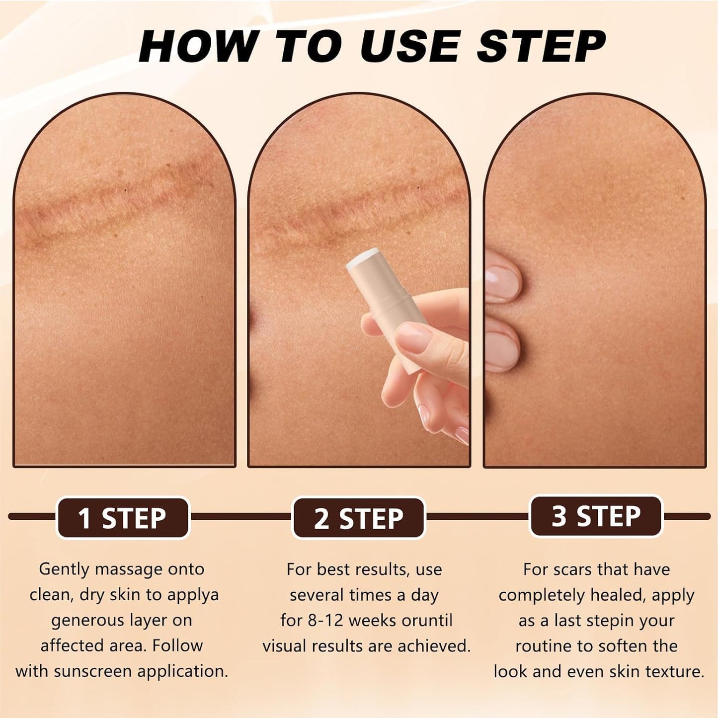 Silicon Scar Removal Stick
